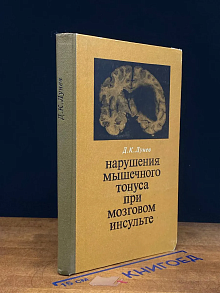 Нарушения мышечного тонуса при мозговом инсульте